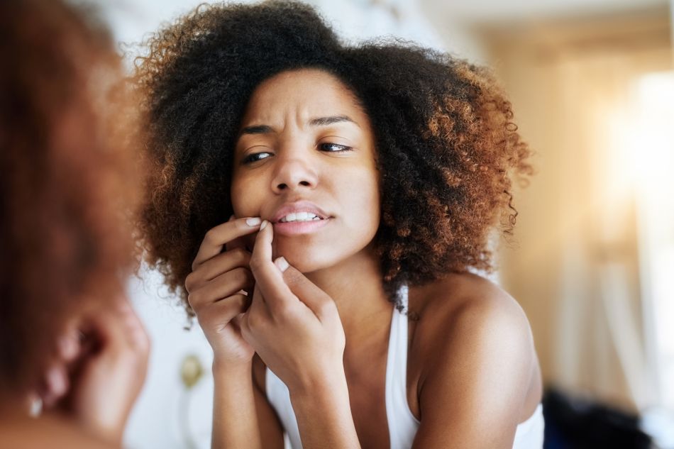 Notre routine beauté pour dire adieu à l’acné